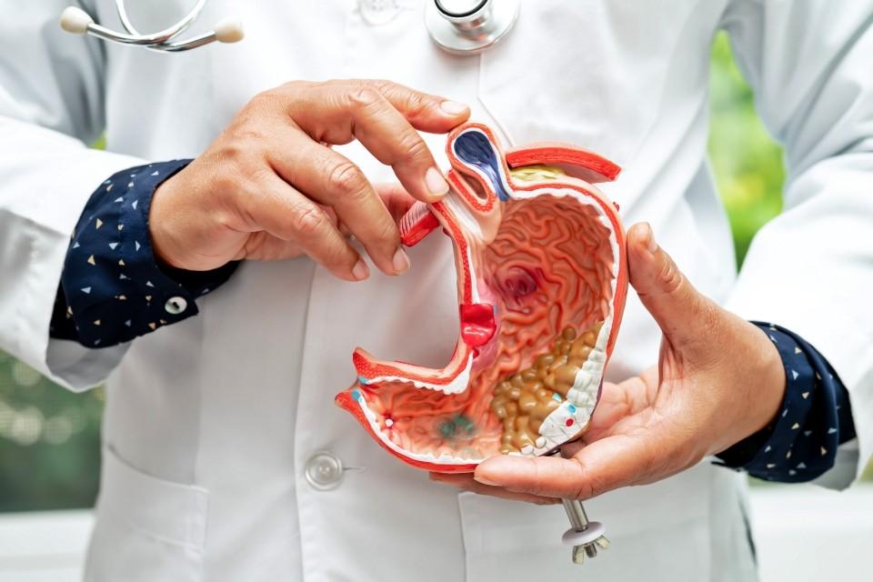 Lower Your Risk of Gastric Cancer with Free Screenings from 365CPS
