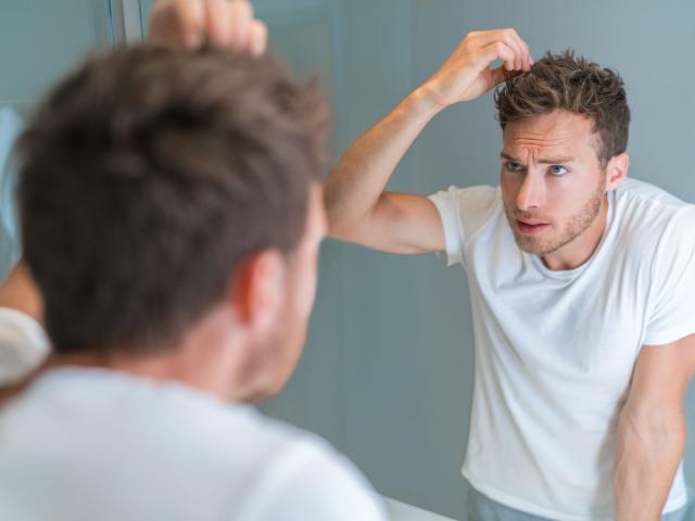Hair Loss