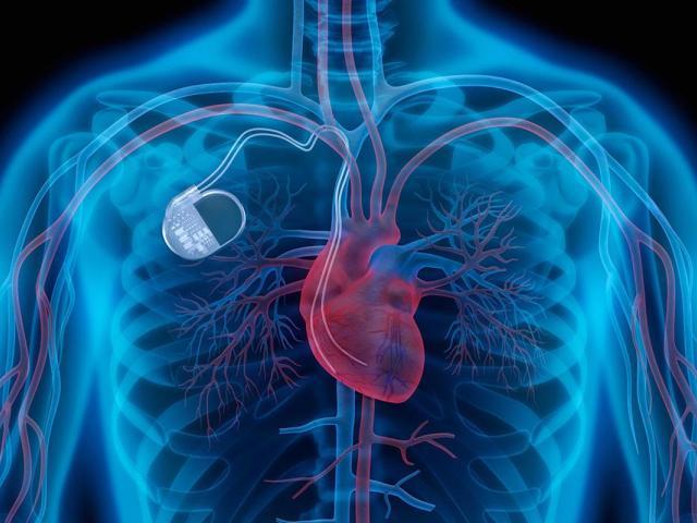 Cadence Heart Centre